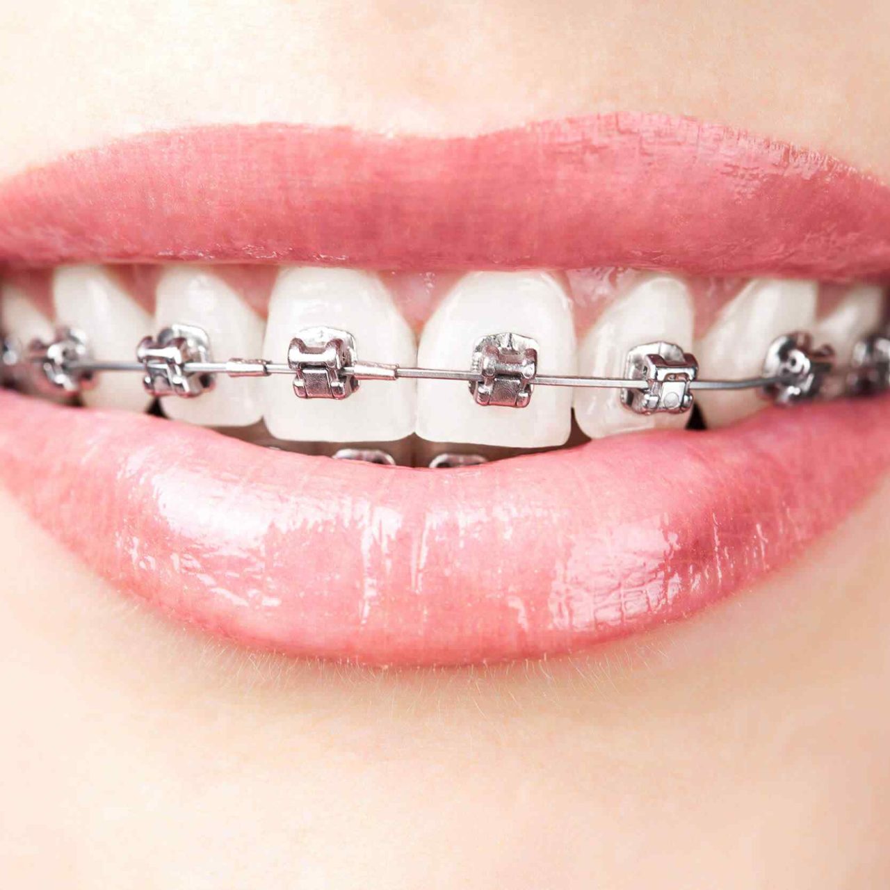 https://dentalamigos.com/wp-content/uploads/2020/01/post-03-1280x1280.jpg