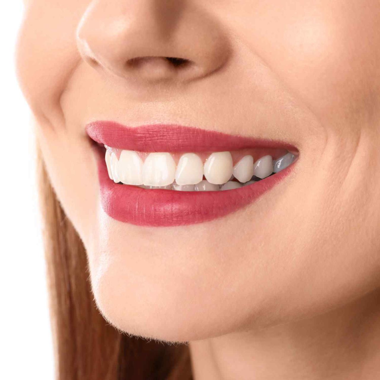 https://dentalamigos.com/wp-content/uploads/2020/03/service_whitening-1280x1280.jpg